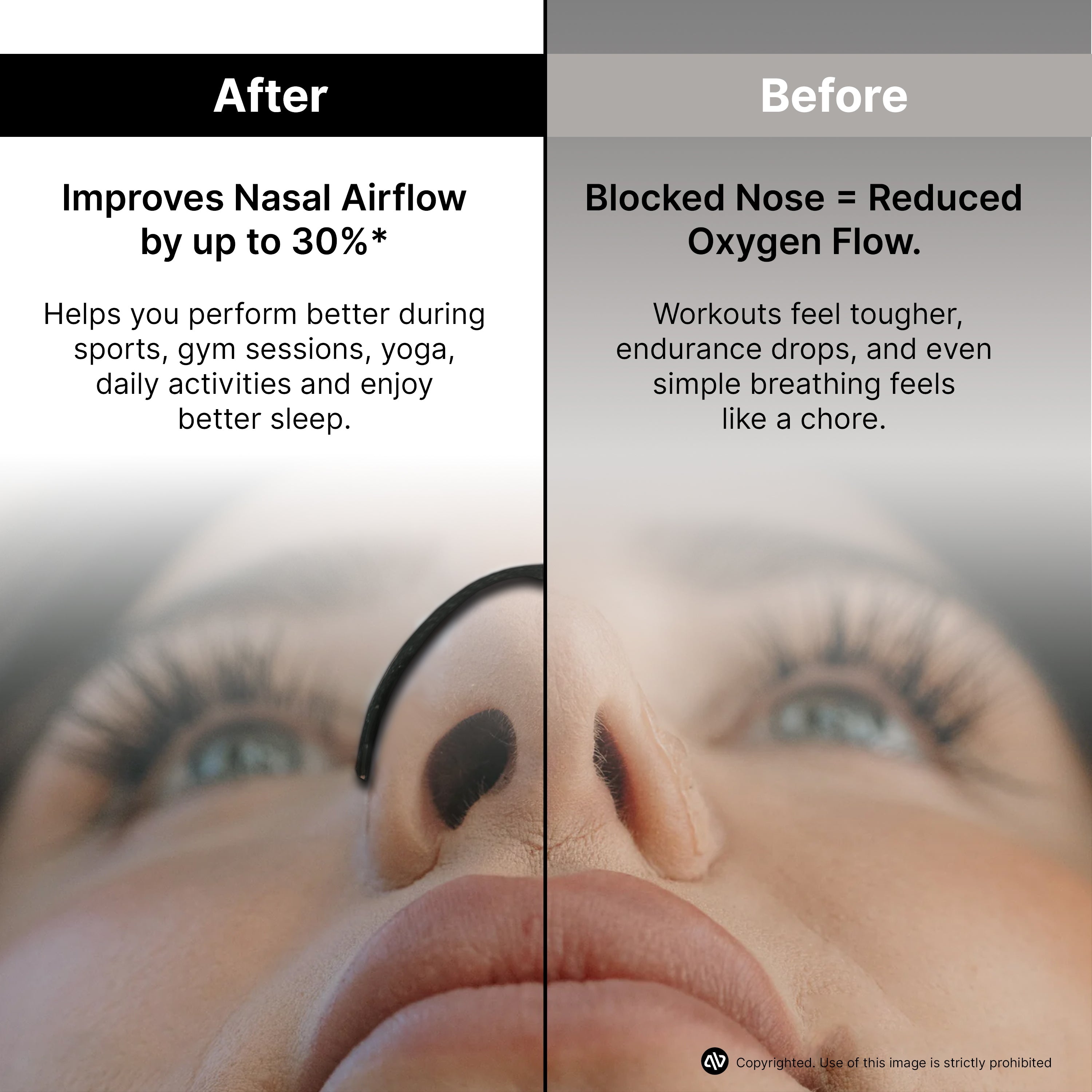 atovio BreatheX Nasal Strip