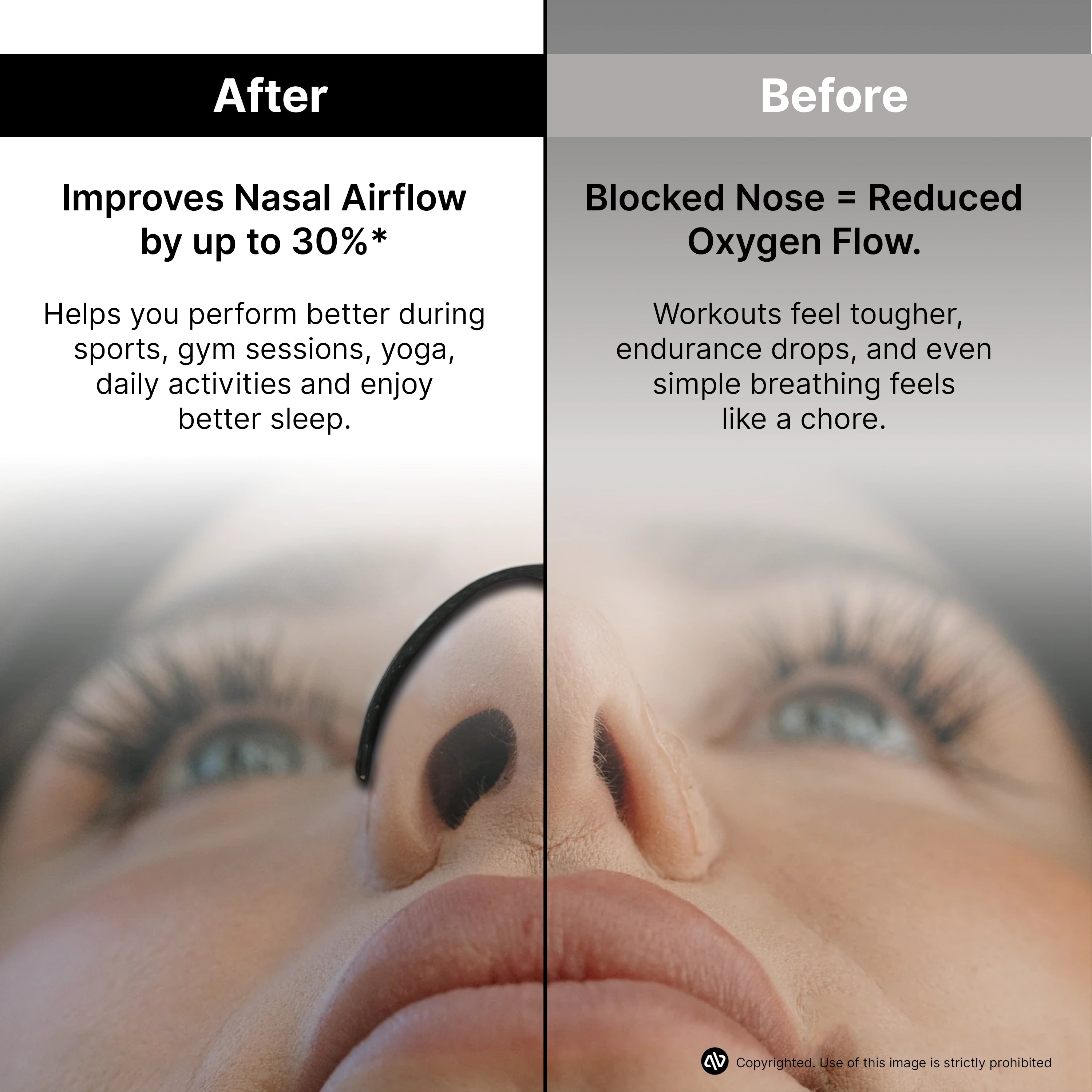 atovio BreatheX Nasal Strip