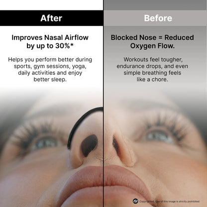 atovio BreatheX Nasal Strip